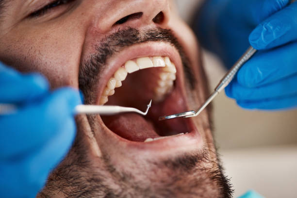Best Dentist for Tooth Abscess  in Winchester, KY
